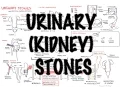 Stones - Overview signs and symptoms risk factors pathophysiology treatment