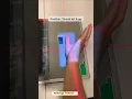 Download Lagu Thumb AP X -ray # Thumb lateral view X-ray #radiography #radiology #radiographer