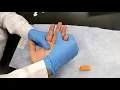 Hematocrit Setup