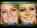 Heidi Montag s Revenge Plastic Surgery
