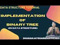 Tree Implementation of Binary Tree Linked List Representation of Binary Tree