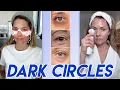 Download Lagu Ultimate Under-Eye Dark Circle Regimen: Devices That Actually Work (Nira, LED, Microcurrent \u0026 More)