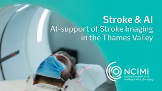 Stroke & AI: How the e-Stroke software is reducing door in door out time for stroke patients