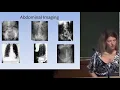 Emma Holliday Surgery W Her Slides USMLE Step 1 2 Shelf Board Exam PowerPoint Download Link