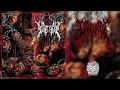 Download Lagu Gorevent - Abnormal Exaggeration [Full Album] (Slamming Brutal Death Metal)