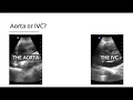 Aorta Versus The IVC