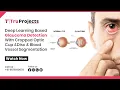 Deep Learning Based Glaucoma Detection With Cropped Optic Cup and Disc and Blood Vessel Segmentation