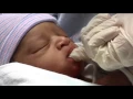 Download Lagu Tongue-Tied: Helping Babies Breastfeed