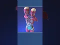 Download Lagu Two Heads, One Body: Anatomy of Conjoined Twins