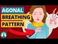 Agonal Breathing Medical Definition Quick Explainer
