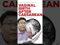 Download Lagu Syarat Bisa Melahirkan Normal Setelah Sesar (VBAC)