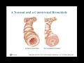 PEC Chapter 7 Anatomy and Physiology Medical Terminology