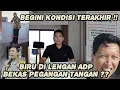Download Lagu GAK DITUTUPI LAGI !! TERBUKTI LENG4N KANAN ARYA DARU BEKAS DIPEGANG TANG4N SEBEGITU KUATNYA ??
