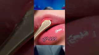 افضل وصفة لتنعيم وتوريد الشفايف 