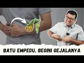 Lagu Gejala batu empedu yang sering tidak di sadari- DOKTER SADDAM ISMAIL