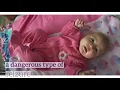 Signs of Infantile Spasms