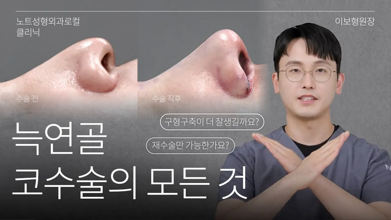[이보형 원장의 Q&A] 기증늑 vs 자가늑  l 구축 확률 l 코재수술 l 노트성형외과