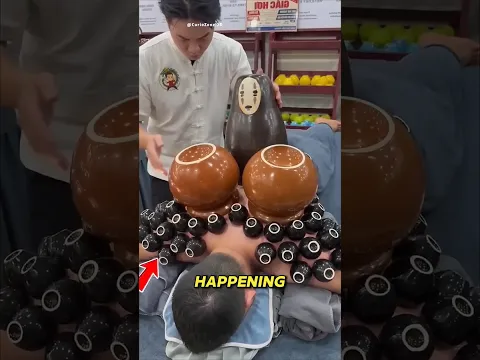 This Is Why People Are Afraid of Cupping Therapy 😱 #short
