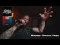 Download Lagu Erase The Day - Wounds (OFFICIAL VIDEO)