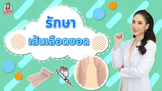 เส้นเลือดขอดเกิดจากสาเหตุอะไรบ้าง และมีปัจจัยใดที่ส่งผลต่อการเกิดโรค?