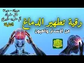 Lagu رقية تنظيف الرأس والدماغ من السحر والحسد والعقد وعلاج الصداع والنبض والخدر ستشعر بشيء ينسحب ويخرج