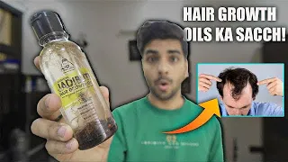 Download Kya ye Wapas HAIR GROWTH karega Urbangabru jadibuti hair growth oil review MP3