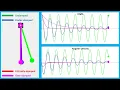 Animation using Matlab Free vibration Undamped vs underdamped vs critically damped vs overdamped