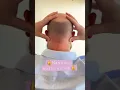 Do You Get Headaches Try This Acupressure Massage