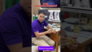 อาการปวดหลังที่ลามลงสะโพก ไปถึงก้นและขา สาเหตุหลักคืออะไร