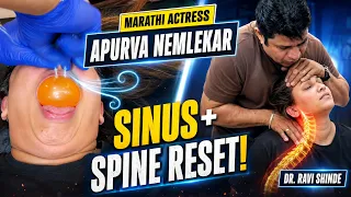 Marathi Actress Apurva Nemlekar Sinus & Spine Reset | Dr Ravi Shinde Chiropractor Mumbai Thane Pune