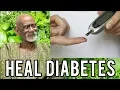 Dr Sebi Reveals What To Eat To Cure Diabetes