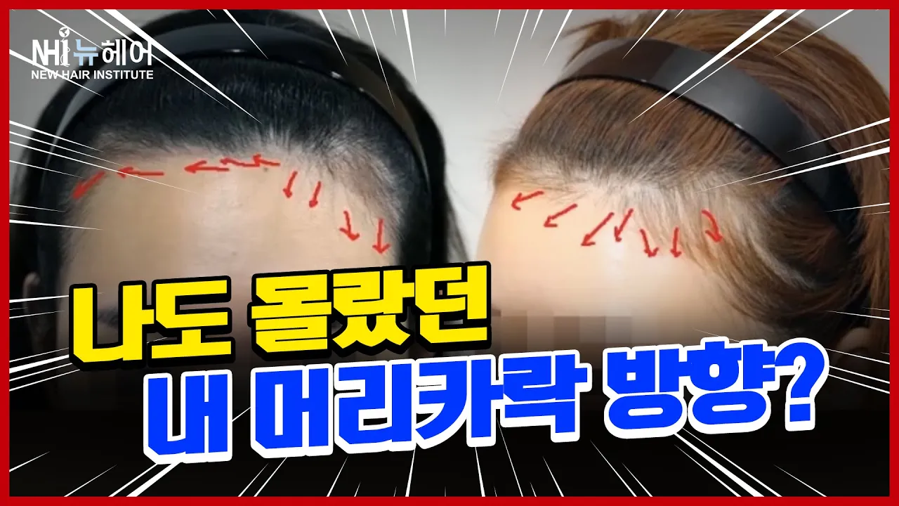 나도 몰랐던 머리카락 방향, 확인해보자 - 뉴헤어 I 헤어라인
