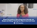 How Atopic Dermatitis Is Diagnosed Beyond the Rash Dr Kendra Joseph