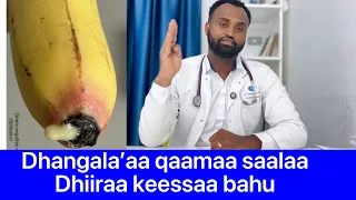 Dhangala’aa qaama saalaa dhiiraa keessaa bahuu fi of eeggannoo gochuu qabdan