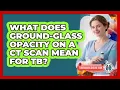 What Does Ground-glass Opacity On A CT Scan Mean For TB - Tuberculosis Disease Guide