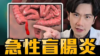 盲腸炎、闌尾炎不一定要開刀? 10年研究告訴你答案