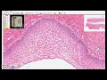 non-keratinized stratified squamous epithelium
