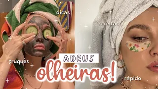 COMO ACABAR COM AS OLHEIRAS | 15 TRUQUES PARA SE LIVRAR DAS OLHEIRAS EM MINUTOS! *dicas, segredos*