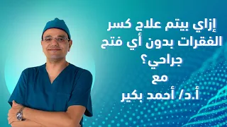 إزاي بيتم علاج كسر الفقرات بدون أي فتح جراحي  دندنها