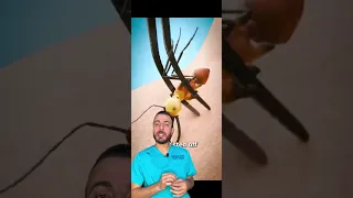 كيفيه خياطه الجروح بالنمل                                      تجميل  اكسبلور  نحت دندنها