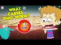 Download Lagu What Causes Ringworms? | Skin Infection | The Dr Binocs Show | Peekaboo Kidz