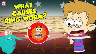 What Causes Ringworms Skin Infection The Dr Binocs Show Peekaboo Kidz 