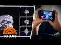 Ground-breaking look at the impact of screen time on kids brains