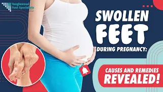swollen feet during pregnancy causes and remedies revealed 