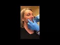 Dr Swelstad Vollure Lip Injection Demonstration