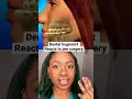Dental hygienist reacts to jaw surgery