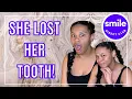 Smile Direct Club HORROR STORY - She lost a tooth