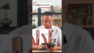 ทำไมการนวดคอถึงอาจทำให้เกิดสโตรกสมองได้