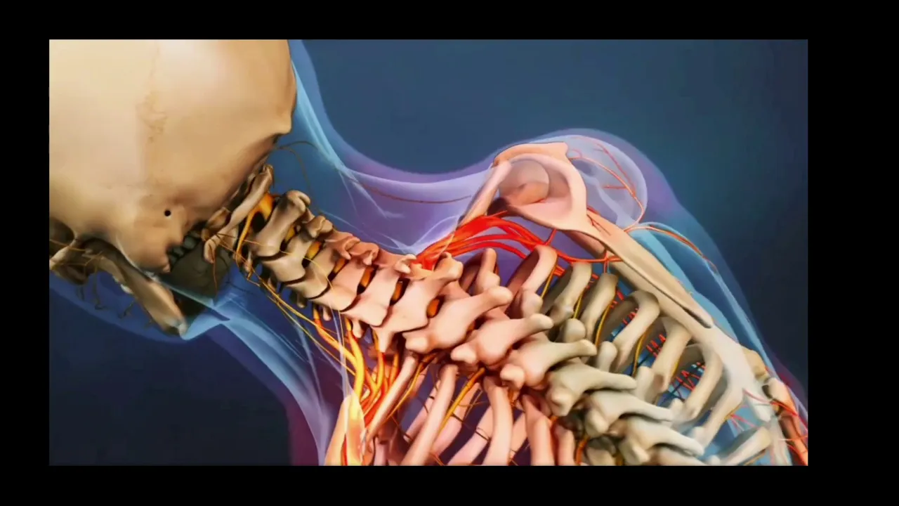 Herniated Cervical Discs. 