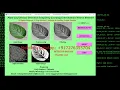Plant Disease Classification Using CNN Python Code Plant Disease Identification Using Python Code